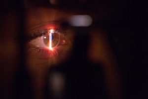 Read more about the article Should I get laser eye surgery?